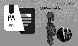 میزان شیوع پوکی استخوان در آذربایجان شرقی بالا است