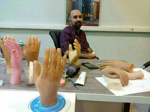 ایران در جمع ۵ کشور تولید کننده دست و انگشت مصنوعی