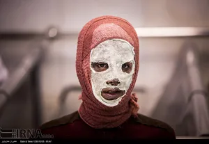 سوختگی های مواد محترقه قابل ترمیم نیست