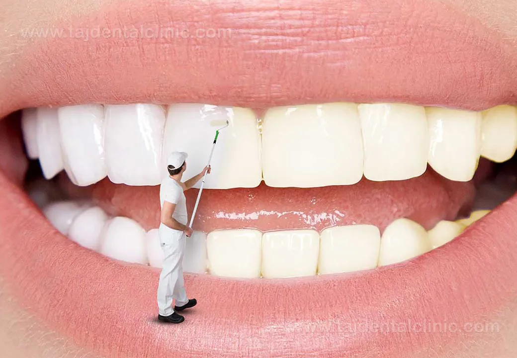 چگونه از دندان های خود مراقبت کنیم؟