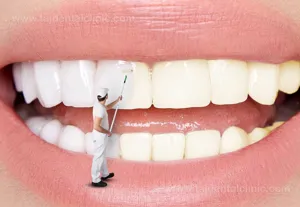 چگونه از دندان های خود مراقبت کنیم؟