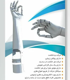 \"دست الکترونیکی با قابلیت کنترل انگشتان با امواج مغزی\" توسط مهندسان تبریزی اختراع شد